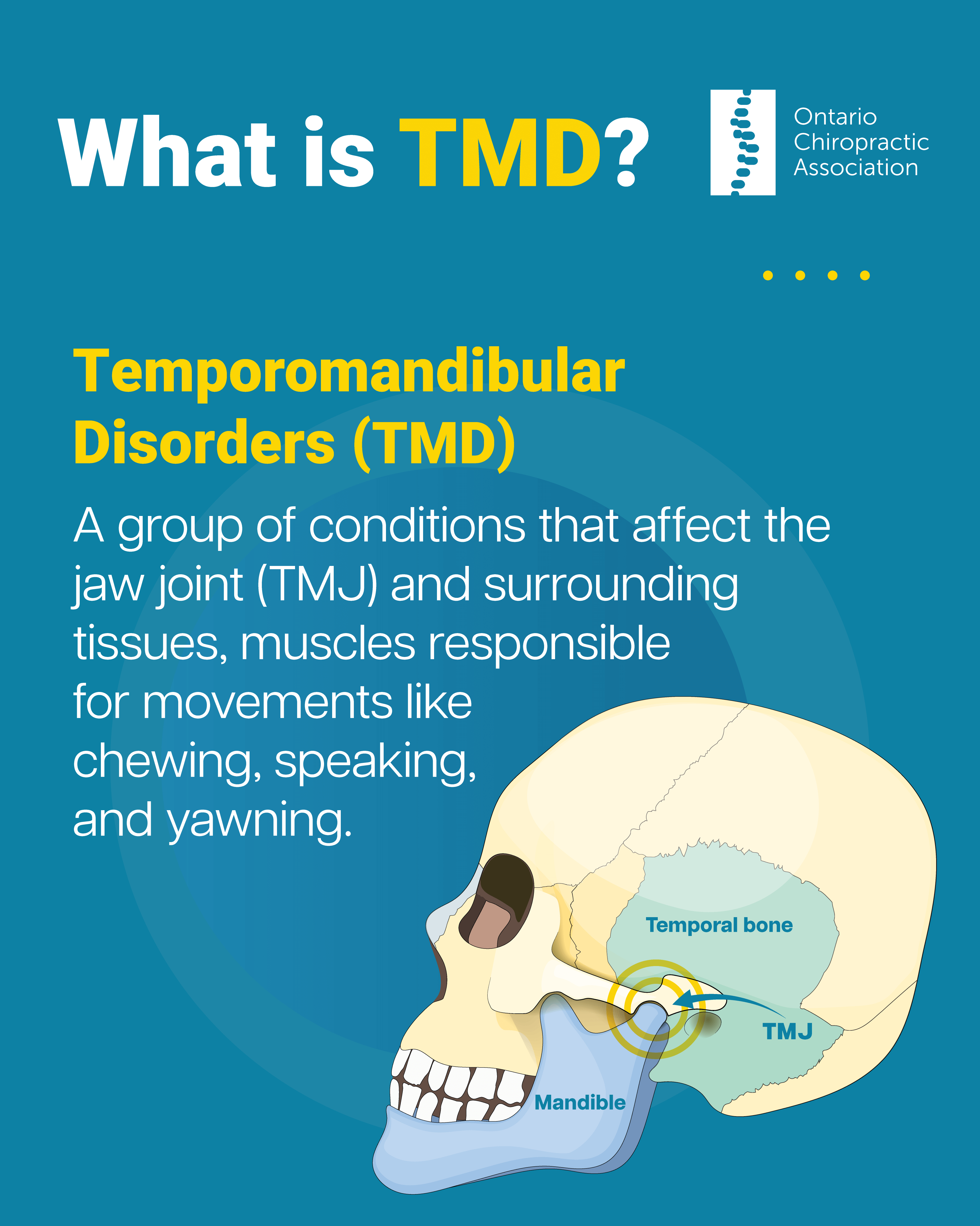 what is TMD?